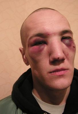 По факту избиения полицией посетителей рязанского клуба «Дом культуры» возбуждено уголовное дело